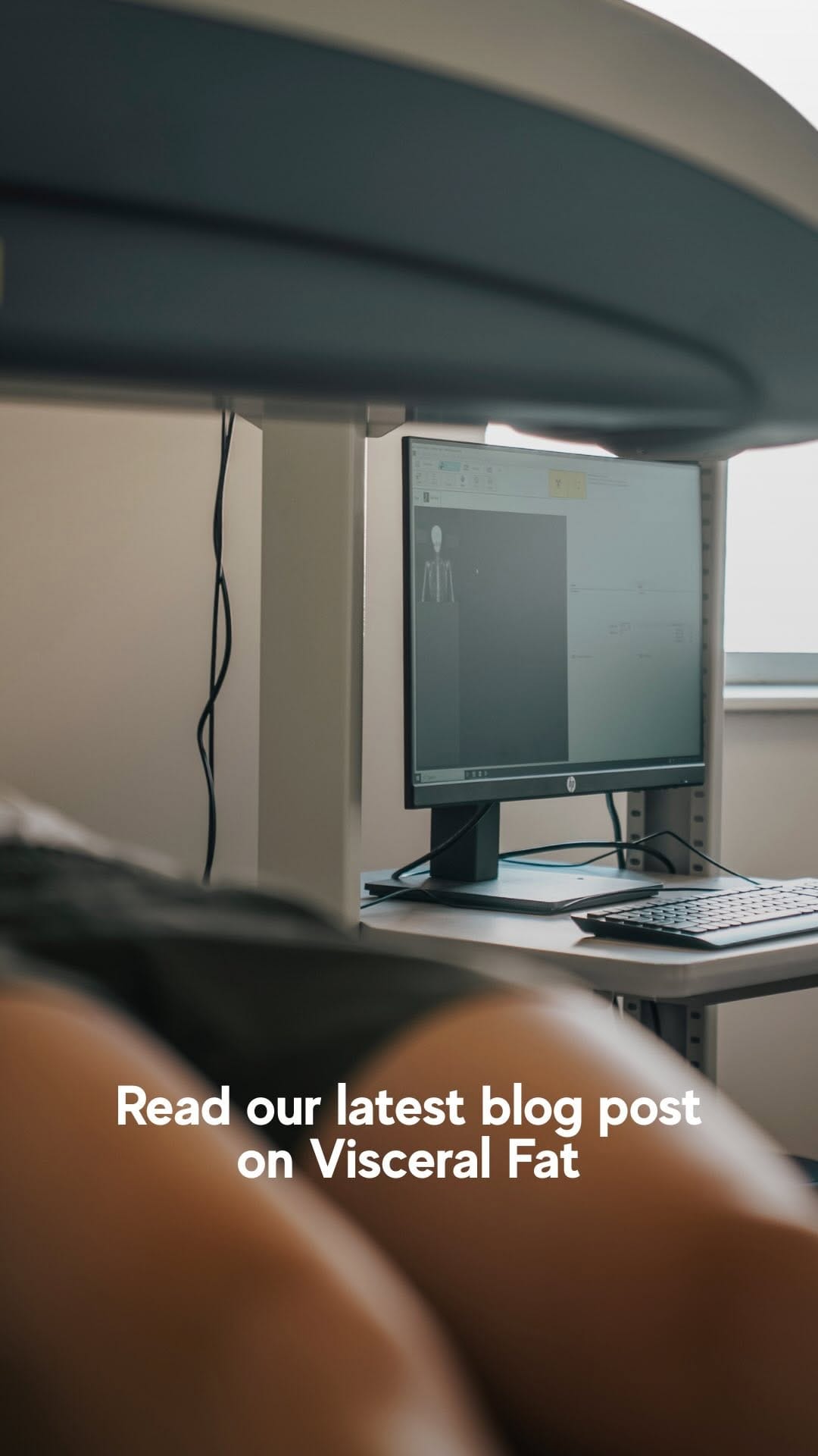 Computer monitor with a prompt to read our latest blog post on visceral fat