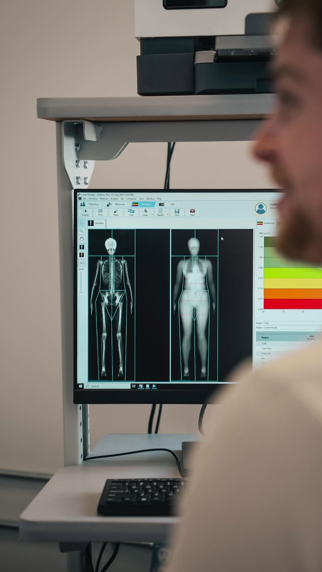 Clinician beside a monitor showing a DEXA scan